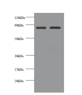 CDH12 / Cadherin 12 Antibody - Western blot of Cadherin-12 antibody at 2 ug/ml. Lane 1: EC109 whole cell lysate. Lane 2: 293T whole cell lysate. Secondary: Goat polyclonal to rabbit IgG at 1:10000 dilution. Predicted band size: 87 kDa. Observed band size: 87 kDa.  This image was taken for the unconjugated form of this product. Other forms have not been tested.