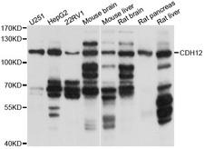 CDH12 / Cadherin 12 Antibody - Western blot analysis of extracts of various cell lines, using CDH12 antibody at 1:1000 dilution. The secondary antibody used was an HRP Goat Anti-Rabbit IgG (H+L) at 1:10000 dilution. Lysates were loaded 25ug per lane and 3% nonfat dry milk in TBST was used for blocking. An ECL Kit was used for detection and the exposure time was 5s.