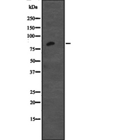 CDH12 / Cadherin 12 Antibody - Western blot analysis of CDH12 expression in Jurkat cells lysate. The lane on the left is treated with the antigen-specific peptide.