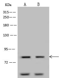 CDH12 / Cadherin 12 Antibody - Anti-CDH12 rabbit polyclonal antibody at 1:500 dilution. Lane A: Jurkat Whole Cell Lysate. Lane B: U 251MG Whole Cell Lysate. Lysates/proteins at 30 ug per lane. Secondary: Goat Anti-Rabbit IgG (H+L)/HRP at 1/10000 dilution. Developed using the ECL technique. Performed under reducing conditions. Predicted band size: 88 kDa. Observed band size: 88 kDa.