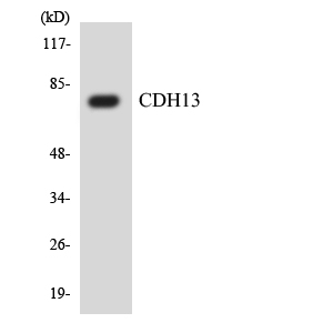 CDH13 / Cadherin 13 Antibody - Western blot analysis of the lysates from HT-29 cells using CDH13 antibody.