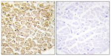 CDH13 / Cadherin 13 Antibody - Immunohistochemistry analysis of paraffin-embedded human heart tissue, using CDH13 Antibody. The picture on the right is blocked with the synthesized peptide.