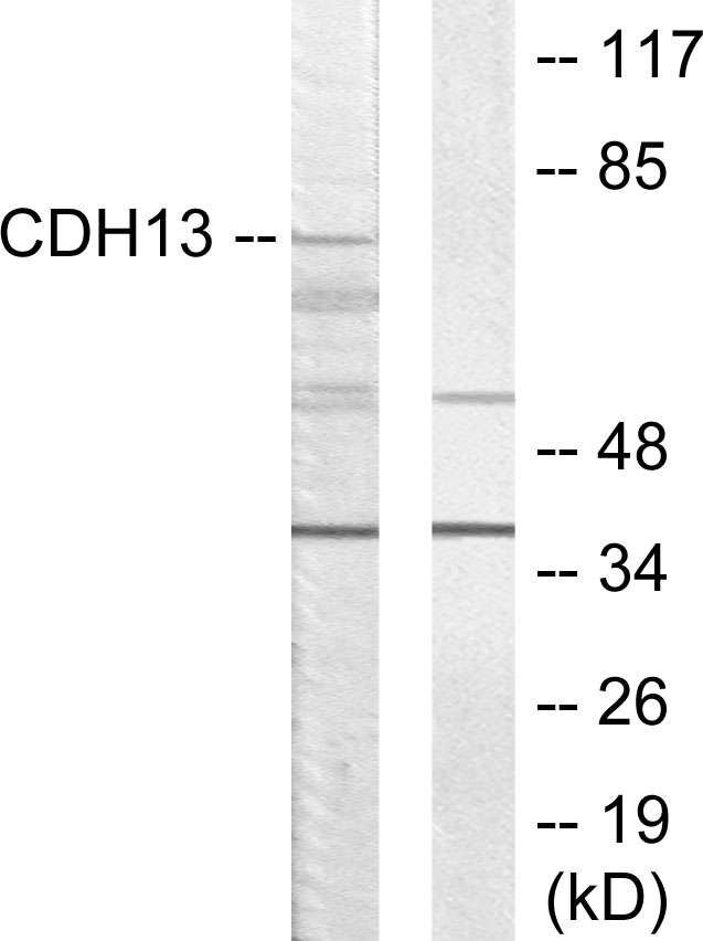 CDH13 / Cadherin 13 Antibody - Western blot analysis of lysates from LOVO cells, using CDH13 Antibody. The lane on the right is blocked with the synthesized peptide.