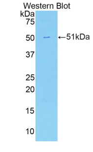 CDH13 / Cadherin 13 Antibody - Western blot of recombinant CDH13 / Cadherin 13.  This image was taken for the unconjugated form of this product. Other forms have not been tested.