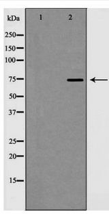 CDH13 / Cadherin 13 Antibody - Western blot of T-cadherin expression in HT29 cell lysate