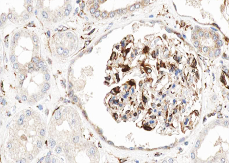 CDH13 / Cadherin 13 Antibody - 1:100 staining human kidney tissue by IHC-P. The tissue was formaldehyde fixed and a heat mediated antigen retrieval step in citrate buffer was performed. The tissue was then blocked and incubated with the antibody for 1.5 hours at 22°C. An HRP conjugated goat anti-rabbit antibody was used as the secondary.