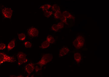 CDH13 / Cadherin 13 Antibody - Staining LOVO cells by IF/ICC. The samples were fixed with PFA and permeabilized in 0.1% Triton X-100, then blocked in 10% serum for 45 min at 25°C. The primary antibody was diluted at 1:200 and incubated with the sample for 1 hour at 37°C. An Alexa Fluor 594 conjugated goat anti-rabbit IgG (H+L) Ab, diluted at 1/600, was used as the secondary antibody.