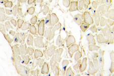 CDH13 / Cadherin 13 Antibody - IHC T-cadherin (M352) pAb in paraffin-embedded human heart tissue.