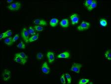 CDH15 / M Cadherin Antibody - Immunofluorescence staining of HepG2 cells with CDH15 Antibody at 1:133, counter-stained with DAPI. The cells were fixed in 4% formaldehyde, permeabilized using 0.2% Triton X-100 and blocked in 10% normal Goat Serum. The cells were then incubated with the antibody overnight at 4°C. The secondary antibody was Alexa Fluor 488-congugated AffiniPure Goat Anti-Rabbit IgG(H+L).