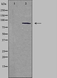 CDH15 / M Cadherin Antibody - Western blot analysis of extracts of HepG2 cells using CDH15 antibody. The lane on the left is treated with the antigen-specific peptide.