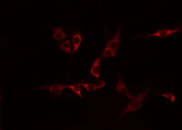 CDH15 / M Cadherin Antibody - Staining HepG2 cells by IF/ICC. The samples were fixed with PFA and permeabilized in 0.1% Triton X-100, then blocked in 10% serum for 45 min at 25°C. The primary antibody was diluted at 1:200 and incubated with the sample for 1 hour at 37°C. An Alexa Fluor 594 conjugated goat anti-rabbit IgG (H+L) Ab, diluted at 1/600, was used as the secondary antibody.