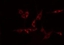 CDH15 / M Cadherin Antibody - Staining HepG2 cells by IF/ICC. The samples were fixed with PFA and permeabilized in 0.1% Triton X-100, then blocked in 10% serum for 45 min at 25°C. The primary antibody was diluted at 1:200 and incubated with the sample for 1 hour at 37°C. An Alexa Fluor 594 conjugated goat anti-rabbit IgG (H+L) Ab, diluted at 1/600, was used as the secondary antibody.