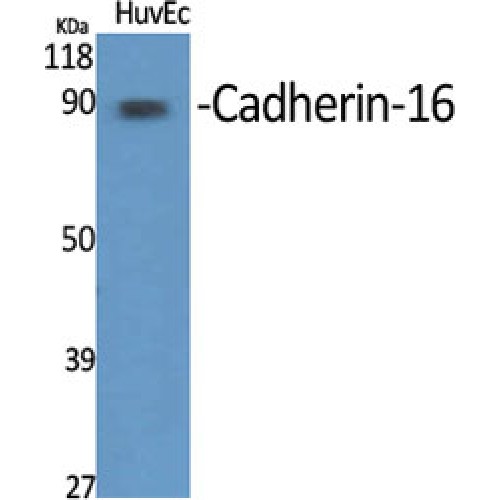 CDH16 / Cadherin 16 Antibody - Western blot of Cadherin-16 antibody