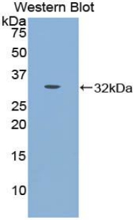 CDH16 / Cadherin 16 Antibody - Western blot of recombinant CDH16 / Cadherin 16.
