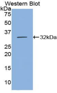 CDH16 / Cadherin 16 Antibody - Western blot of recombinant CDH16 / Cadherin 16.