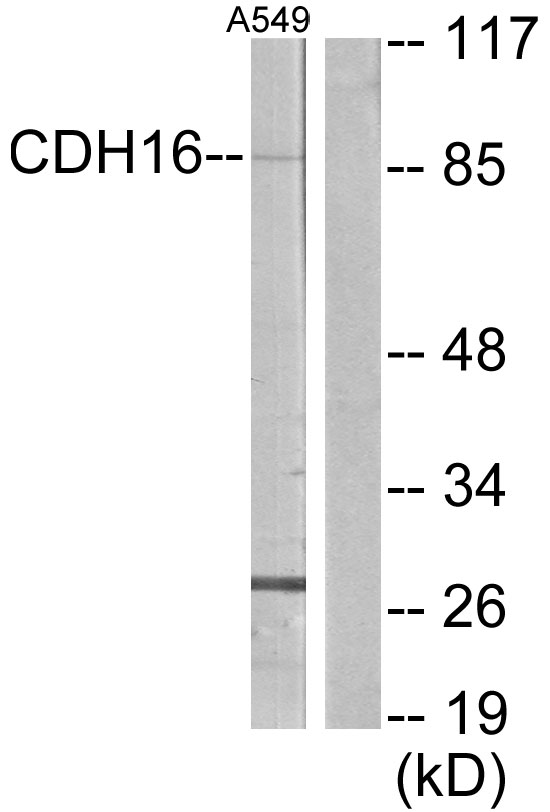 CDH16 / Cadherin 16 Antibody - Western blot analysis of lysates from A549 cells, using CDH16 Antibody. The lane on the right is blocked with the synthesized peptide.