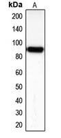 CDH16 / Cadherin 16 Antibody - Western blot analysis of KSP Cadherin expression in Caki1 (A) whole cell lysates.