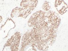 CDH16 / Cadherin 16 Antibody - Chromophobe Cell Renal Carcinoma 1