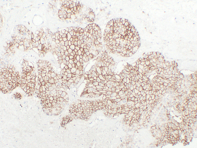 CDH16 / Cadherin 16 Antibody - Chromophobe Cell Renal Carcinoma 2