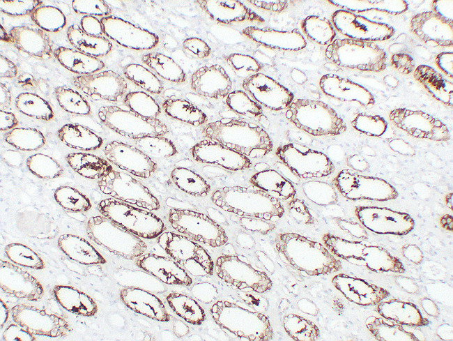 CDH16 / Cadherin 16 Antibody - Renal Clear Cell Carcinoma