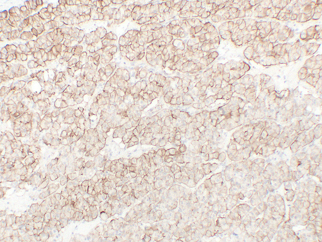 CDH16 / Cadherin 16 Antibody - Renal Oncocytoma
