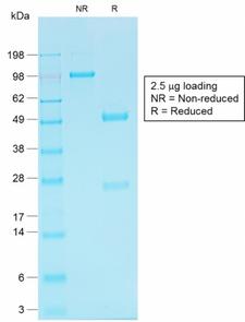 CDH16 / Cadherin 16 Antibody - SDS-PAGE Analysis of Purified KSP-Cadherin Rabbit Recombinant Monoclonal Antibody (CDH16/1532R). Confirmation of Purity and Integrity of Antibody.