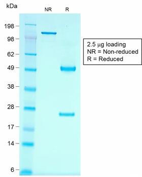 CDH16 / Cadherin 16 Antibody - SDS-PAGE Analysis Purified KSP-Cadherin Recombinant Mouse Monoclonal Antibody (rCDH16/1071). Confirmation of Purity and Integrity of Antibody.