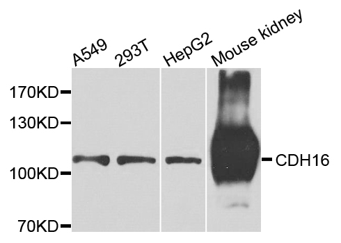 CDH16 / Cadherin 16 Antibody - Western blot analysis of extracts of various cells.