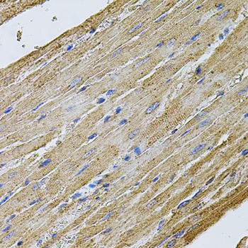CDH16 / Cadherin 16 Antibody - Immunohistochemistry of paraffin-embedded rat heart tissue.