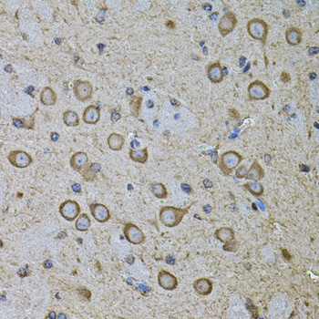 CDH16 / Cadherin 16 Antibody - Immunohistochemistry of paraffin-embedded mouse brain tissue.