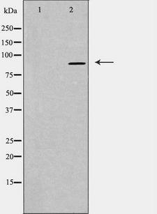 CDH16 / Cadherin 16 Antibody - Western blot analysis of extracts of rat brain cells using CDH16 antibody. The lane on the left is treated with the antigen-specific peptide.