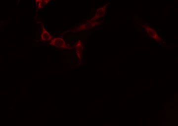 CDH16 / Cadherin 16 Antibody - Staining A549 cells by IF/ICC. The samples were fixed with PFA and permeabilized in 0.1% Triton X-100, then blocked in 10% serum for 45 min at 25°C. The primary antibody was diluted at 1:200 and incubated with the sample for 1 hour at 37°C. An Alexa Fluor 594 conjugated goat anti-rabbit IgG (H+L) Ab, diluted at 1/600, was used as the secondary antibody.