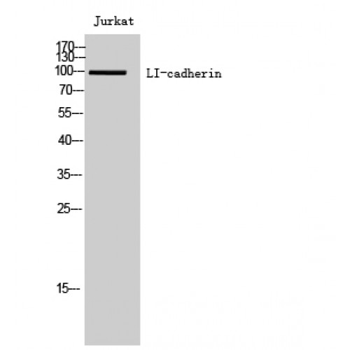 CDH17 / Cadherin 17 Antibody - Western blot of LI-cadherin antibody