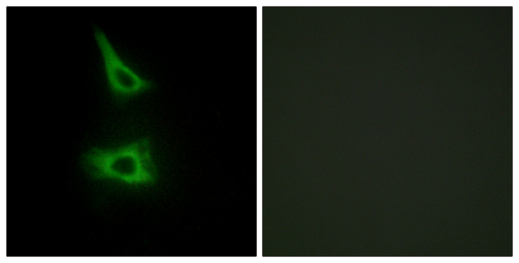 CDH17 / Cadherin 17 Antibody - Immunofluorescence analysis of HeLa cells, using CDH17 Antibody. The picture on the right is blocked with the synthesized peptide.