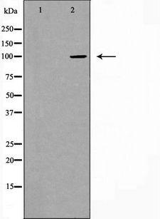 CDH17 / Cadherin 17 Antibody - Western blot analysis of extracts of Jurkat cells using CDH17 antibody. The lane on the left is treated with the antigen-specific peptide.