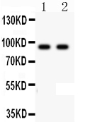 CDH17 / Cadherin 17 Antibody - Western blot - Anti-LI Cadherin Antibody