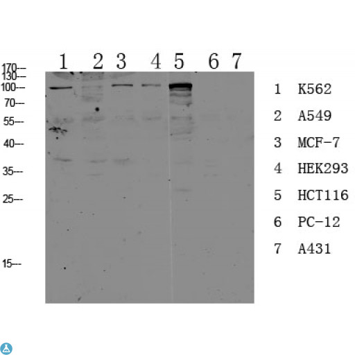 CDH17 / Cadherin 17 Antibody - Western blot analysis of various lysate, antibody was diluted at 1000. Secondary antibody was diluted at 1:20000.
