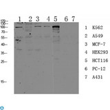 CDH17 / Cadherin 17 Antibody - Western blot analysis of various lysate, antibody was diluted at 1000. Secondary antibody was diluted at 1:20000.