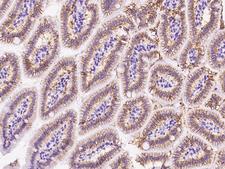 CDH17 / Cadherin 17 Antibody - Immunochemical staining of mouse CDH17 in mouse small intestine with rabbit polyclonal antibody at 1:1000 dilution, formalin-fixed paraffin embedded sections.