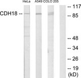 CDH18 / Ey-Cadherin Antibody - Western blot analysis of lysates from HeLa, A549, and COLO205 cells, using CDH18 Antibody. The lane on the right is blocked with the synthesized peptide.