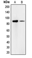 CDH18 / Ey-Cadherin Antibody - Western blot analysis of Cadherin 18 expression in A549 (A); HeLa (B) whole cell lysates.