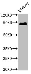 CDH18 / Ey-Cadherin Antibody - Positive Western Blot detected in Mouse kidney tissue. All lanes: CDH18 antibody at 2.4 µg/ml Secondary Goat polyclonal to rabbit IgG at 1/50000 dilution. Predicted band size: 89, 64 KDa. Observed band size: 89 KDa