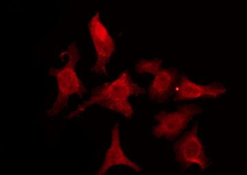 CDH18 / Ey-Cadherin Antibody - Staining HeLa cells by IF/ICC. The samples were fixed with PFA and permeabilized in 0.1% Triton X-100, then blocked in 10% serum for 45 min at 25°C. The primary antibody was diluted at 1:200 and incubated with the sample for 1 hour at 37°C. An Alexa Fluor 594 conjugated goat anti-rabbit IgG (H+L) Ab, diluted at 1/600, was used as the secondary antibody.