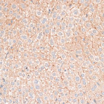 CDH18 / Ey-Cadherin Antibody - Immunohistochemistry of paraffin-embedded Mouse liver using CDH18 Polyclonal Antibody at dilution of 1:100 (40x lens).