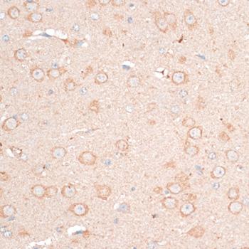 CDH18 / Ey-Cadherin Antibody - Immunohistochemistry of paraffin-embedded Mouse brain using CDH18 Polyclonal Antibody at dilution of 1:100 (40x lens).