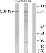 CDH19 / Cadherin 19 Antibody - Western blot analysis of lysates from HepG2 and COLO205 cells, using CDH19 Antibody. The lane on the right is blocked with the synthesized peptide.