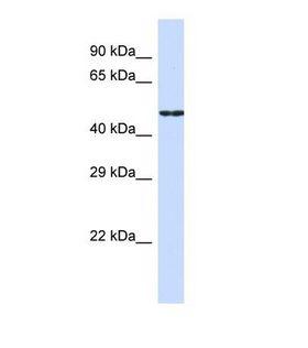 CDH19 / Cadherin 19 Antibody - Western blot of Human HepG2. CDH19 antibody dilution 1.0 ug/ml.  This image was taken for the unconjugated form of this product. Other forms have not been tested.