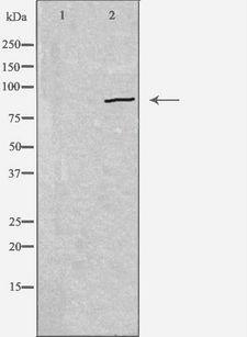 CDH19 / Cadherin 19 Antibody - Western blot analysis of extracts of HepG2 cells using CDH19 antibody. The lane on the left is treated with the antigen-specific peptide.