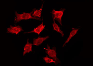 CDH19 / Cadherin 19 Antibody - Staining HepG2 cells by IF/ICC. The samples were fixed with PFA and permeabilized in 0.1% Triton X-100, then blocked in 10% serum for 45 min at 25°C. The primary antibody was diluted at 1:200 and incubated with the sample for 1 hour at 37°C. An Alexa Fluor 594 conjugated goat anti-rabbit IgG (H+L) Ab, diluted at 1/600, was used as the secondary antibody.
