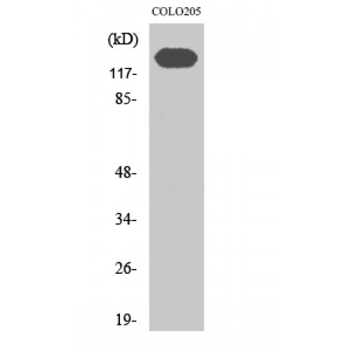 CDH2 / N Cadherin Antibody - Western blot of N-cadherin antibody